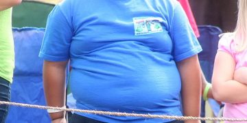 Childhood Obesity
