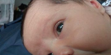 Breastfeeding