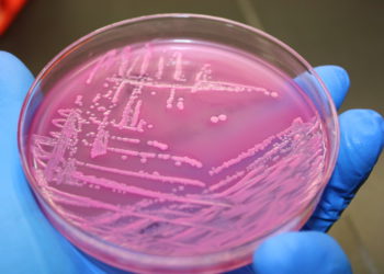 E.coli