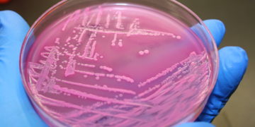 E.coli