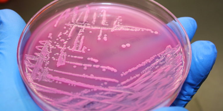 E.coli