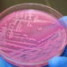 E.coli
