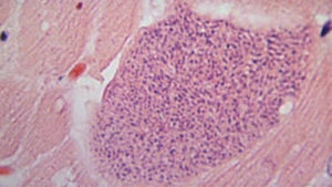Toxoplasma