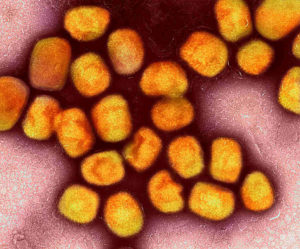 Monkeypox