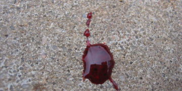 Blood test