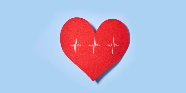 Heart Transplant