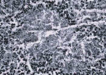 fungus