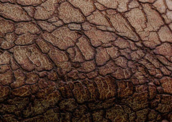 dry skin