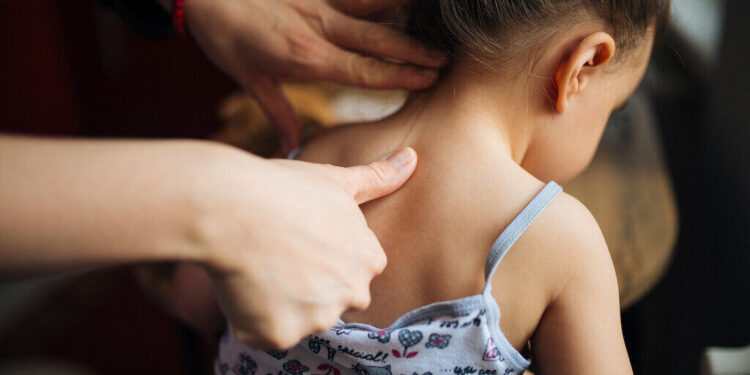 Spine Implant