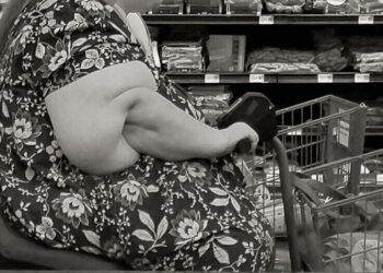 obesity