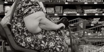 obesity