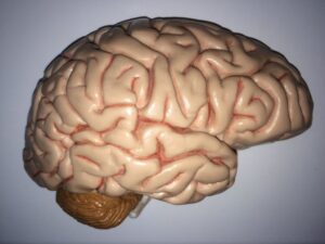 Alzheimer's