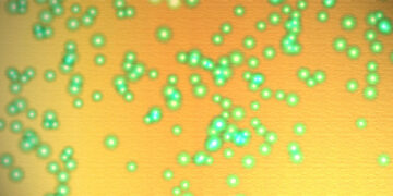 Measles