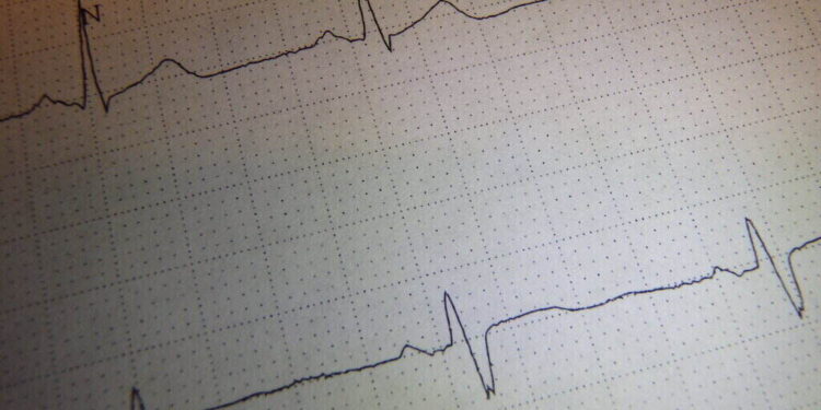 Heart