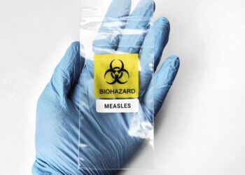 Measles