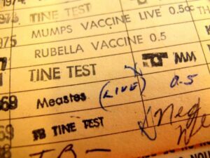 measles