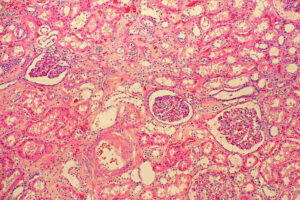 kidney