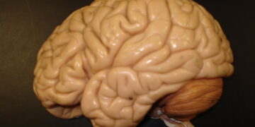 Alzheimer's