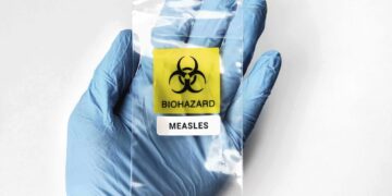 Measles