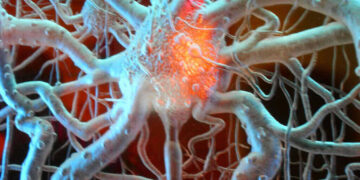 Brain's
