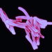 Tuberculosis