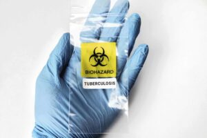 Tuberculosis