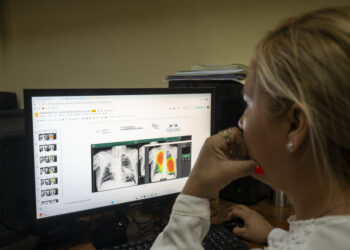 Tuberculosis