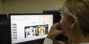 Tuberculosis